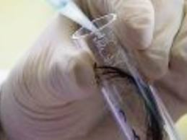 Chemische Mineral Haaranalyse